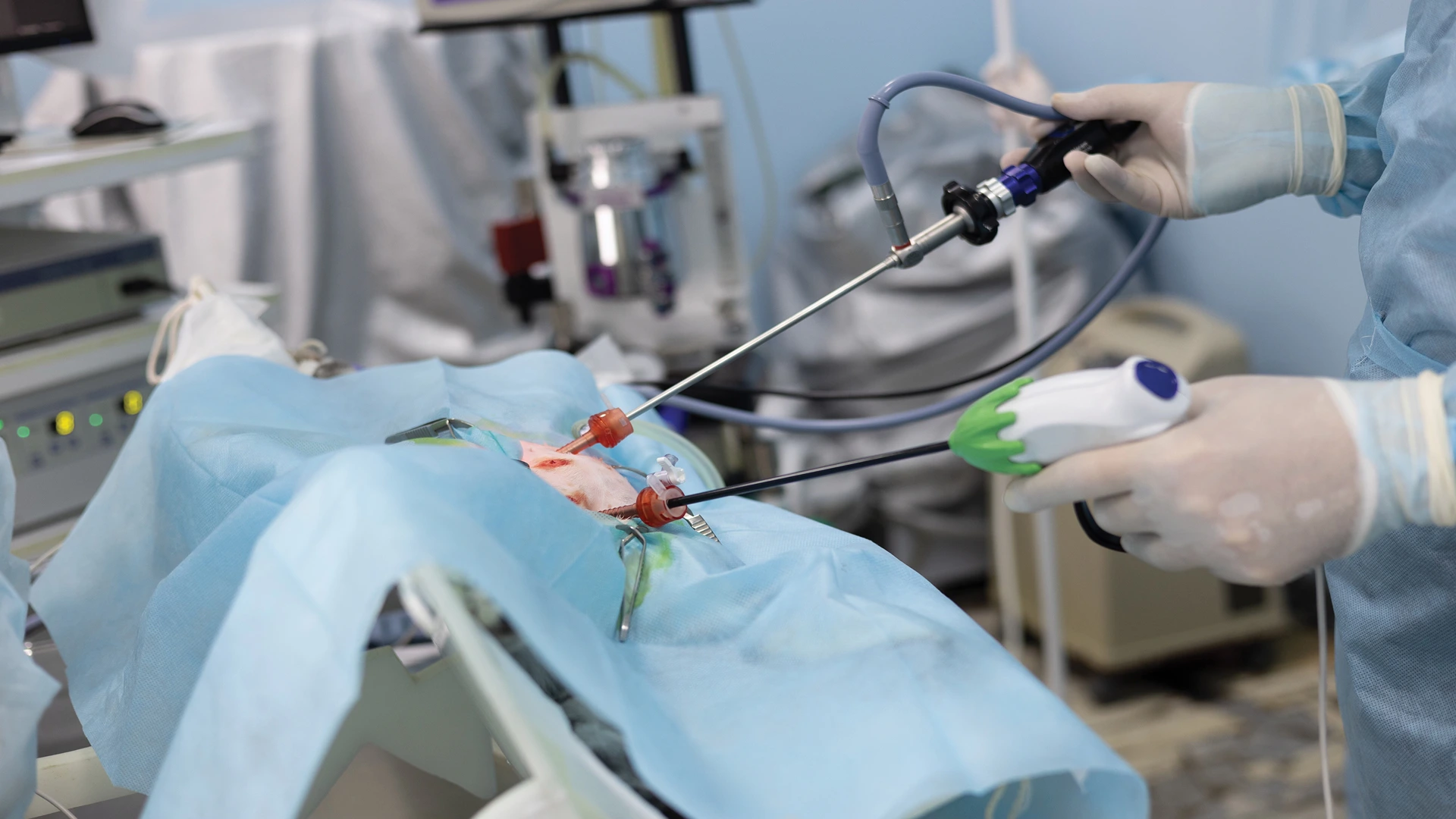 Surgeon performing a minimally invasive laparoscopic procedure using surgical instruments inserted through small incisions covered with blue drapes.