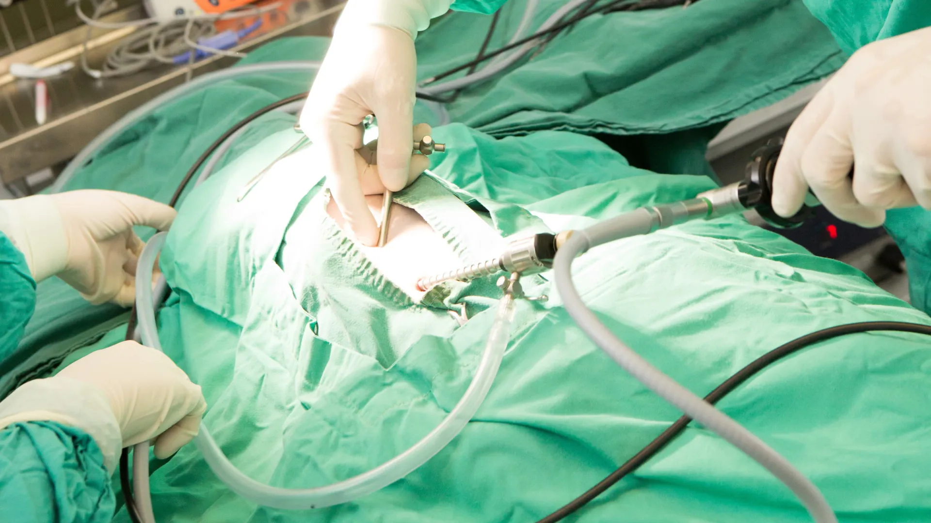 Surgeons in green scrubs performing laparoscopic surgery with specialized instruments on a patient.