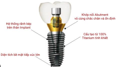 Trụ Implant Dentium Mỹ
