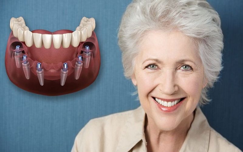 Trồng răng implant có đau không