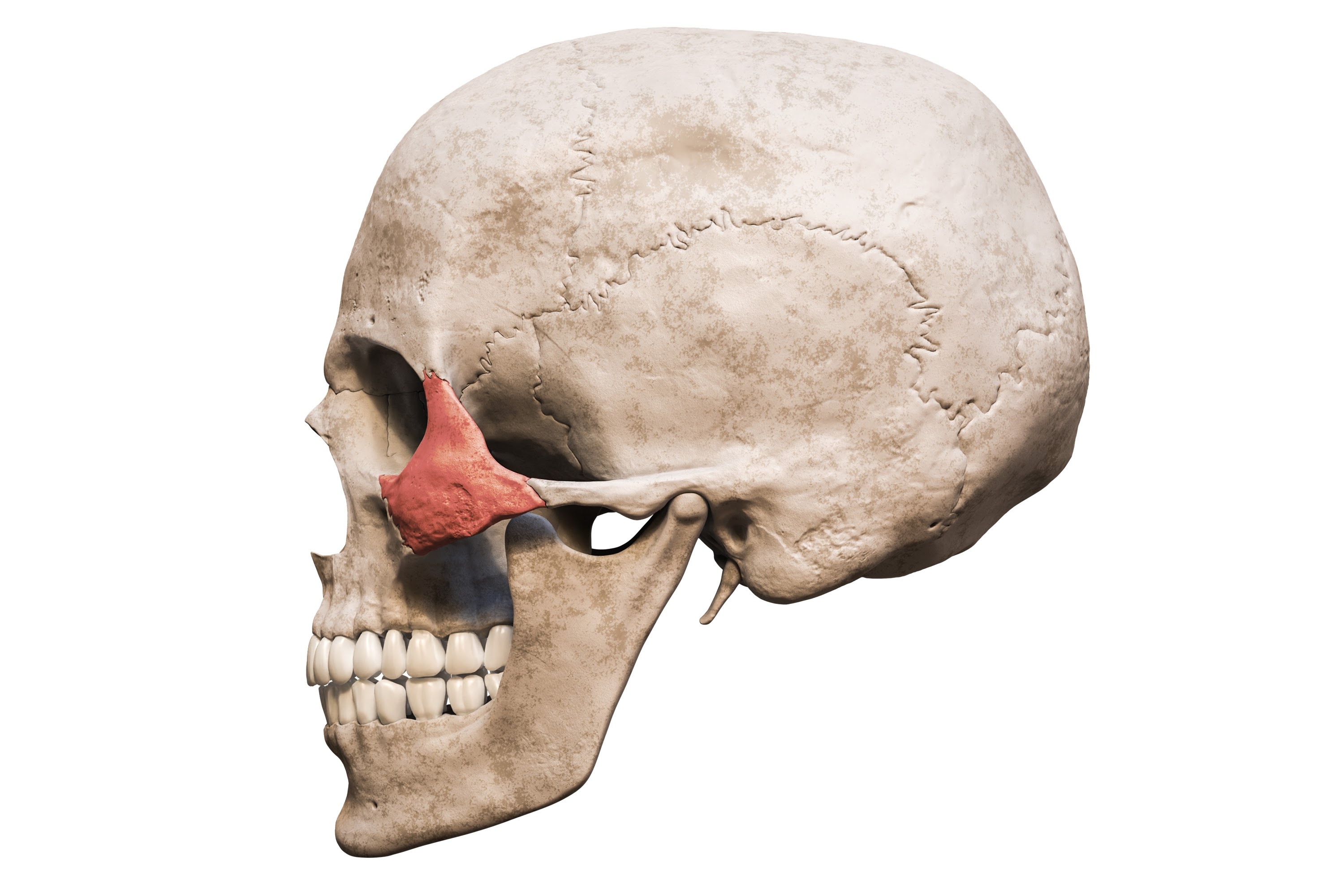 Trồng răng Zygoma