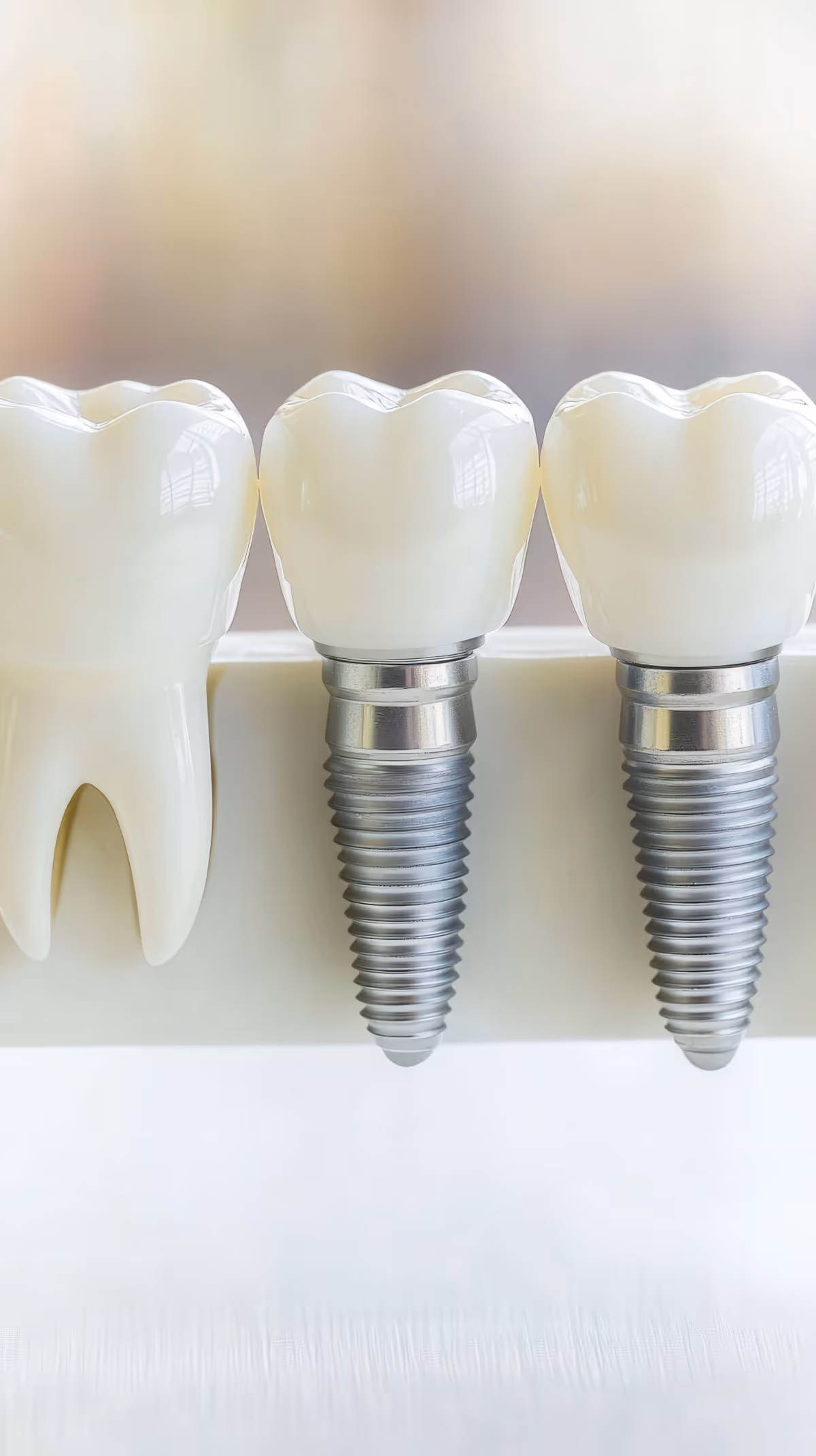 A close-up detailed image showcases three dental implants next to a natural tooth highlighting the clean lines