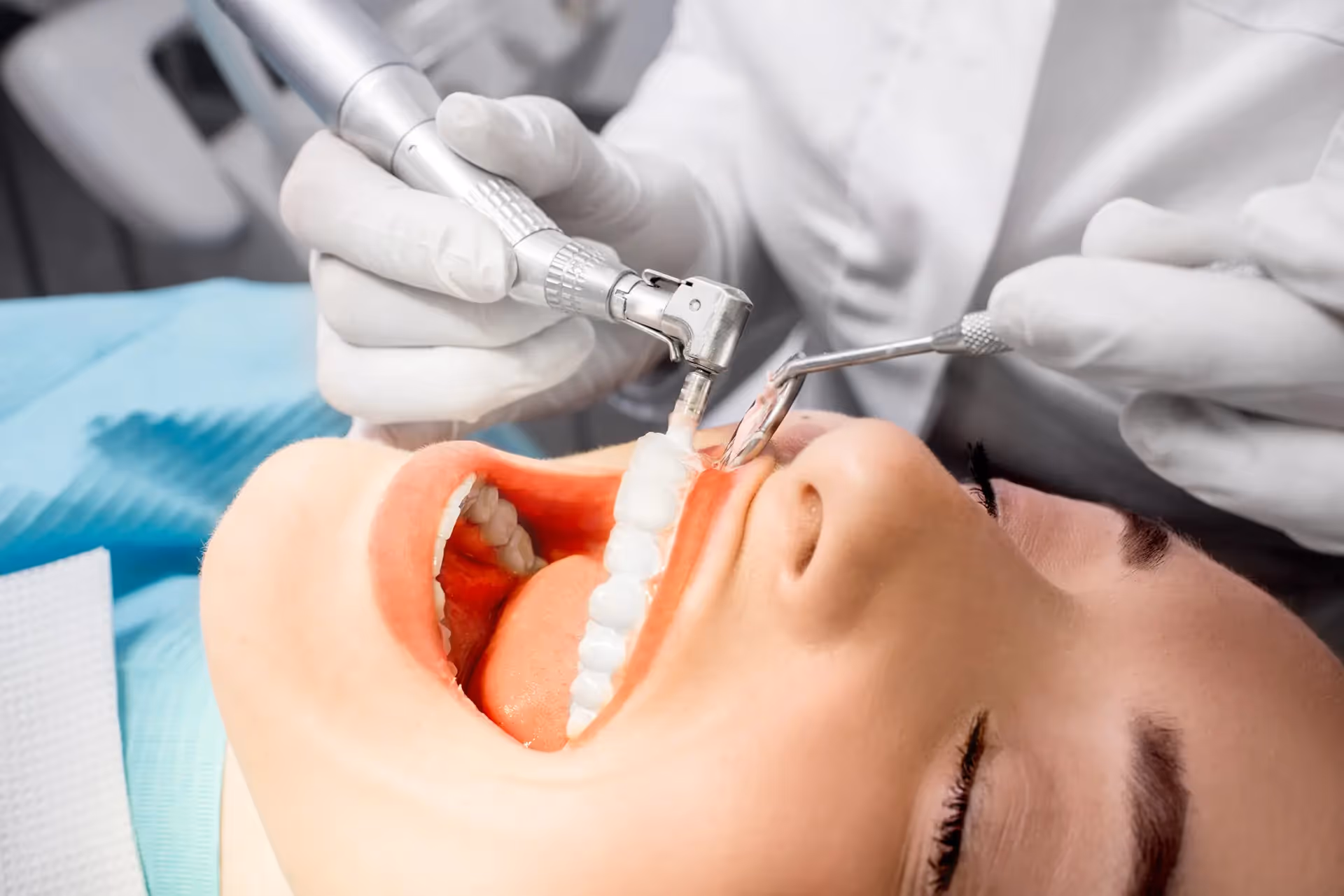 Teeth Cleanings & Exams