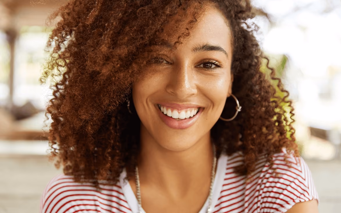A beautiful African-American woman smiles with healthy, white teeth after a celebrity smile makeover in Los Gatos, CA