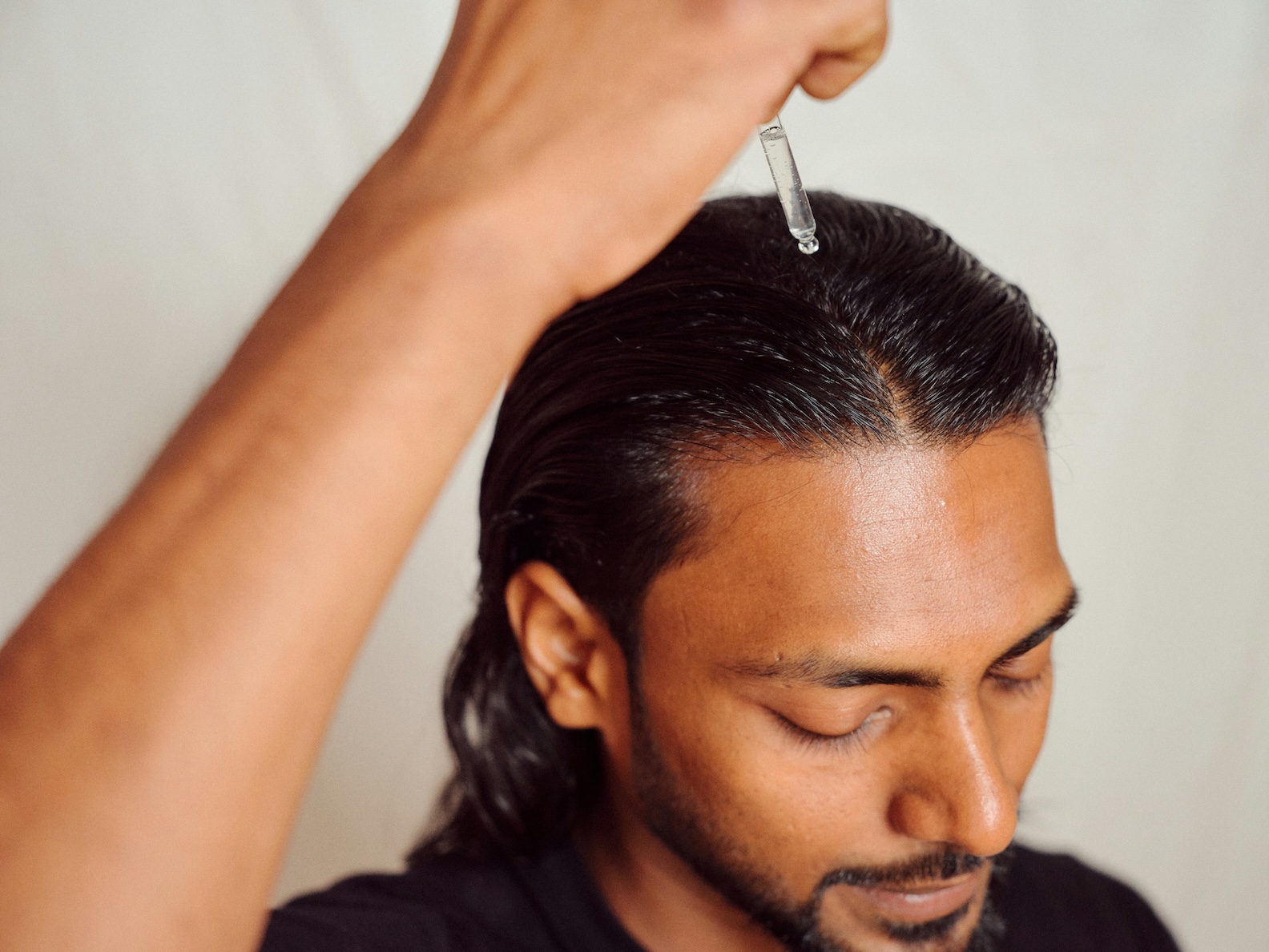 Man applying hair loss treatment to scalp