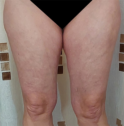 images of past clients