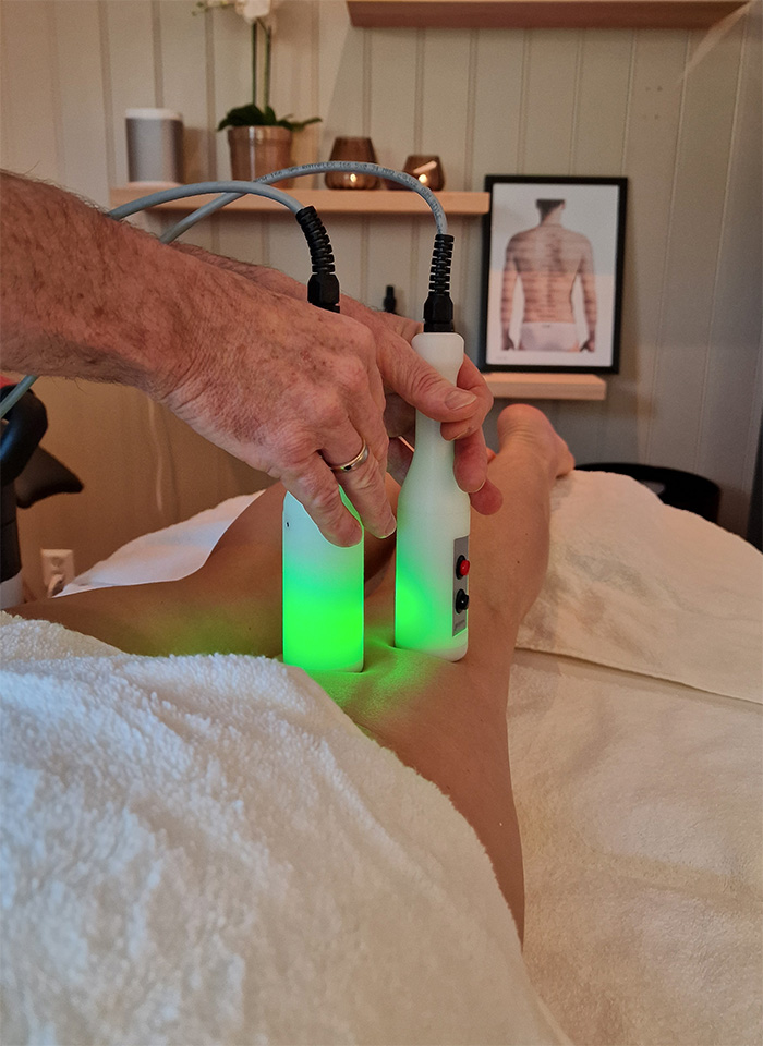 a cryo treatments on legs