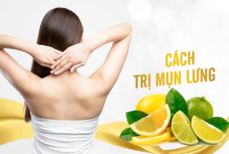 cách trị mụn lưng bằng chanh
