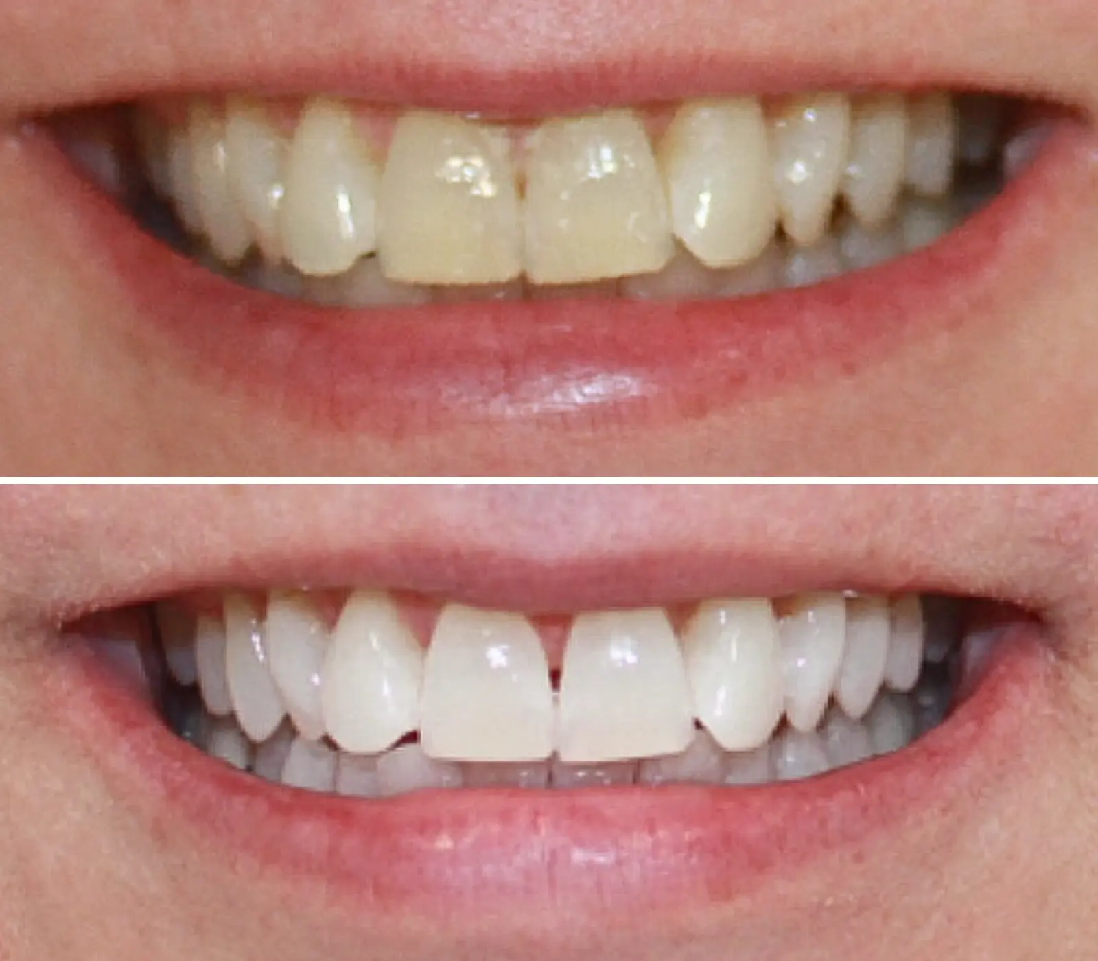 After Image