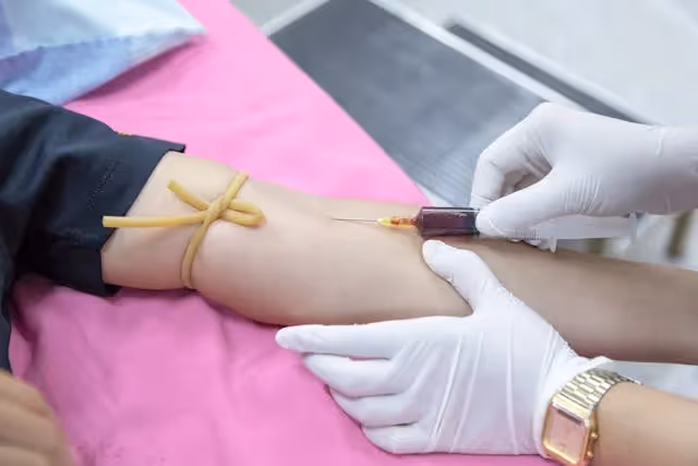 Blood drawing in arm