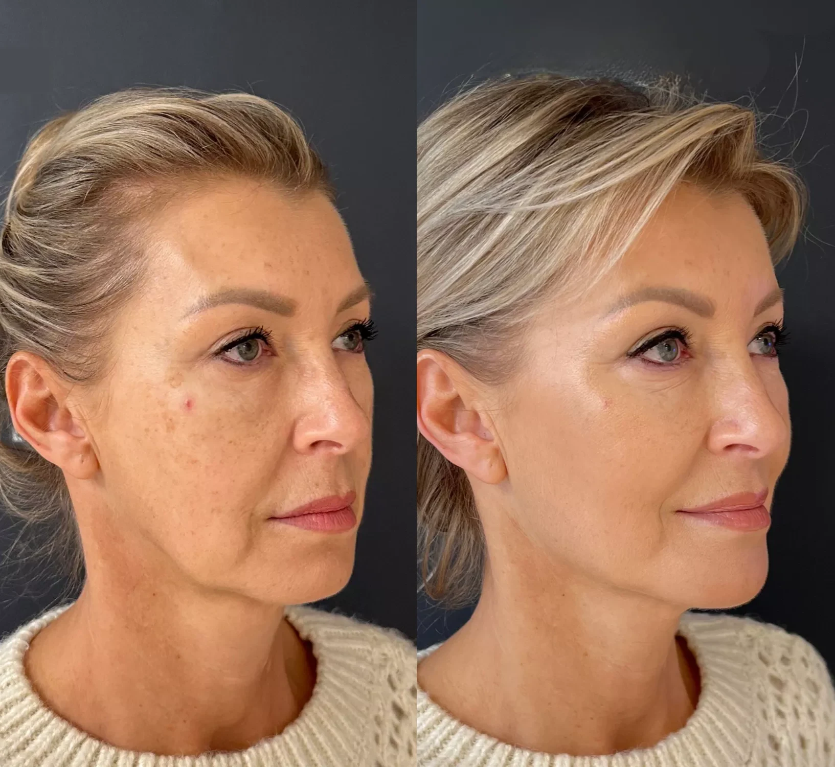 Muscle relaxer patient after treatment