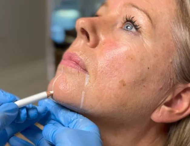 Tighten your jawline, these are the options