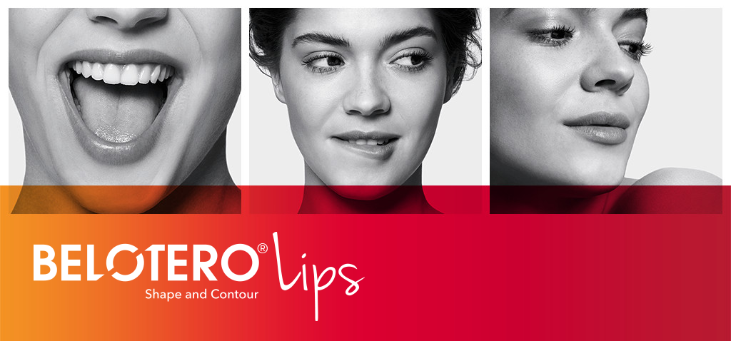 Belotero Lips for professionals | Noscomed Medical Supply A/S