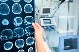 Pediatrik beyin cerrahisi