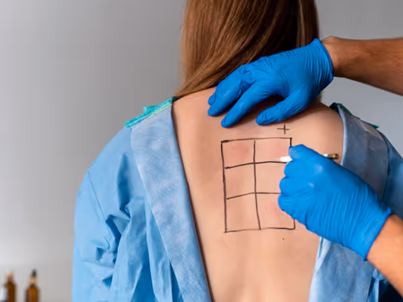 Kifoz Cerrahi Düzeltme – Posterior füzyon ve osteotomi teknikleri