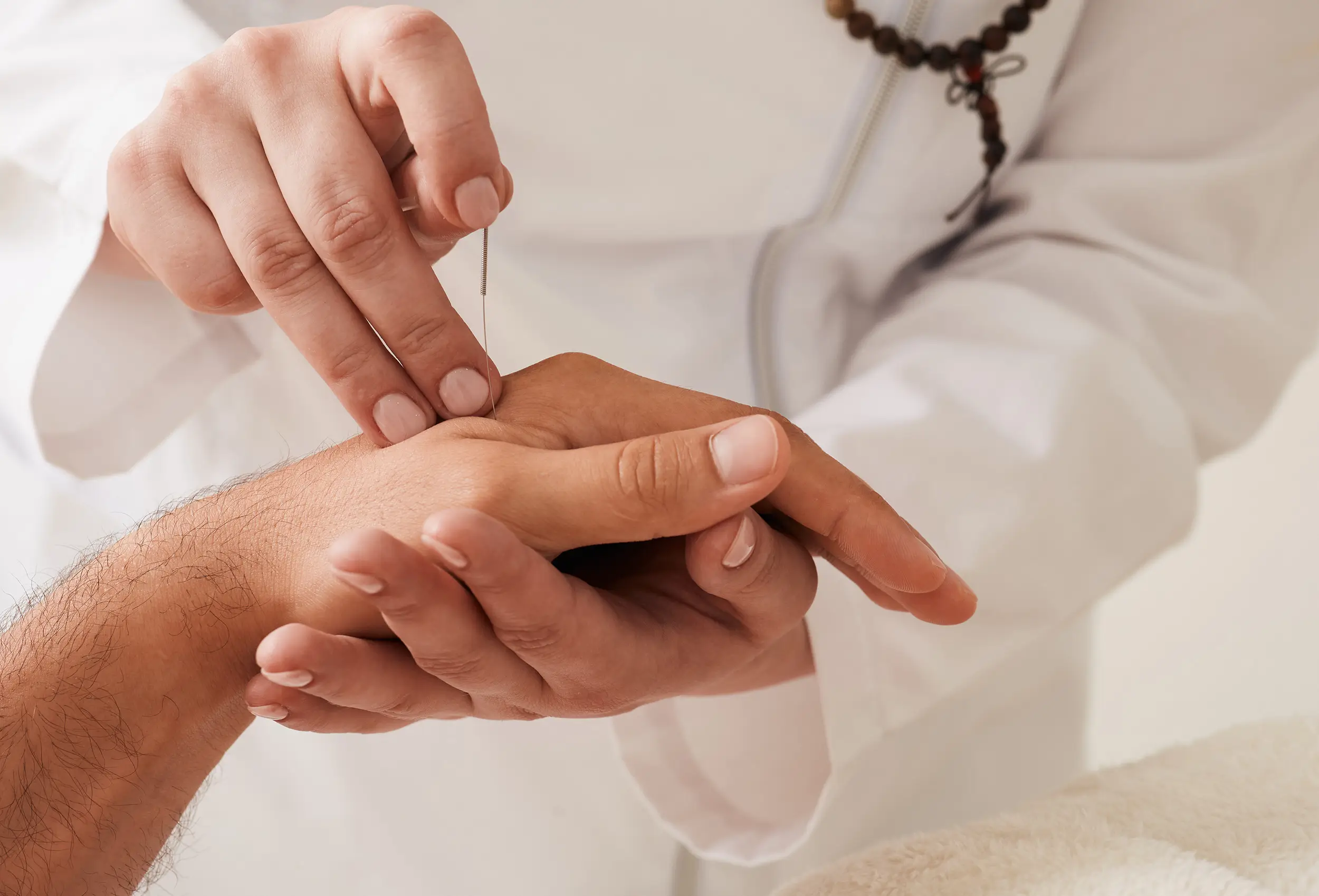 Reflexologist inserting a needle to her patient's hand