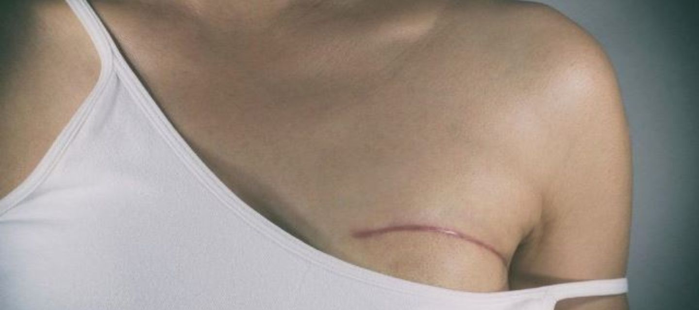 América Latina enfrenta brechas en acceso, diagnóstico