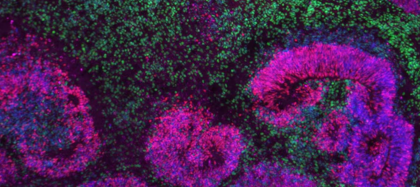 Científicos crean el mayor mapa celular del cerebro humano