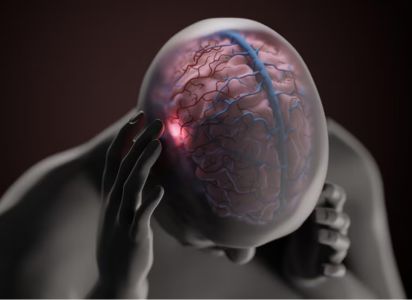 Investigadores exploran genes, ondas cerebrales y moléculas como el CGRP para entender la migraña