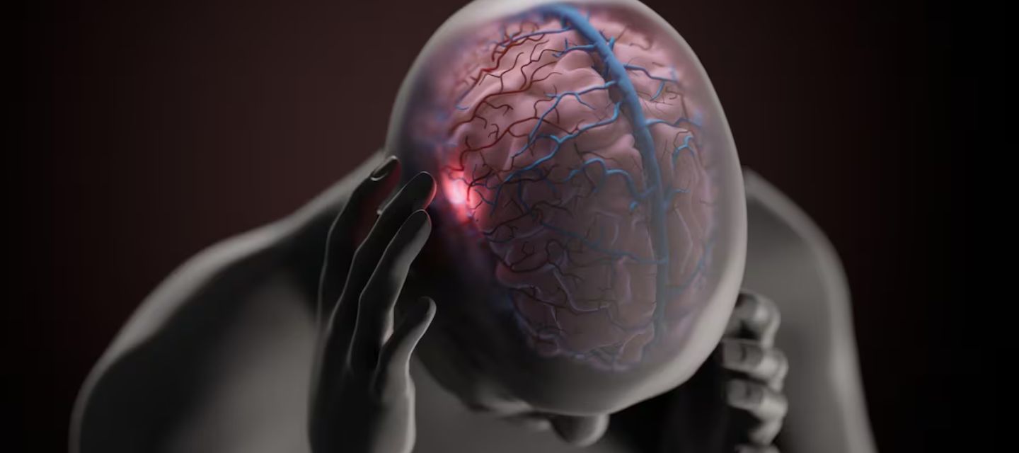 Investigadores exploran genes, ondas cerebrales y moléculas como el CGRP para entender la migraña