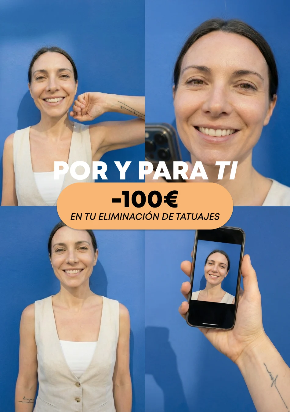 descuento en eliminación de tatuajes