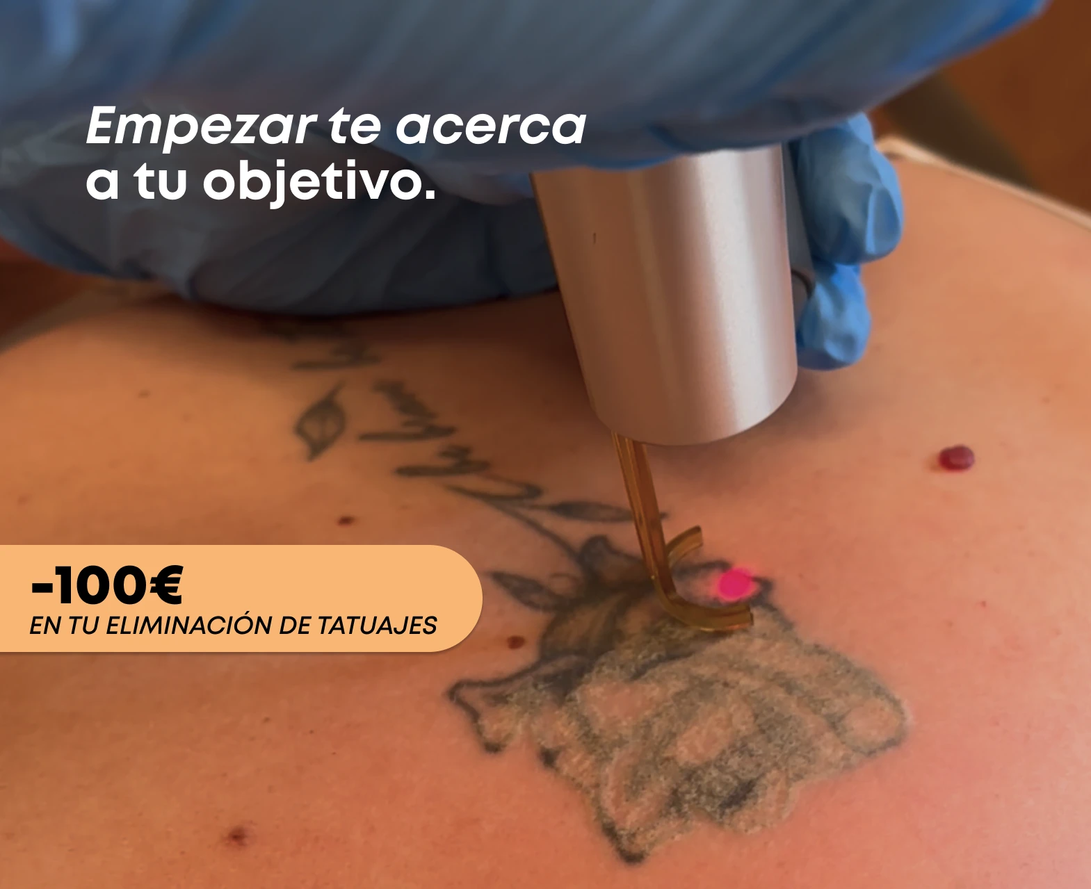 10% de descuento en Full Remove
