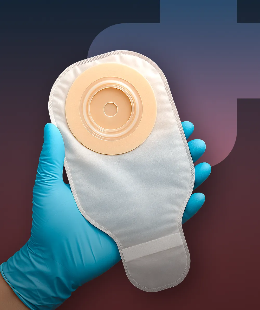 Prise en charge du patient stomisé