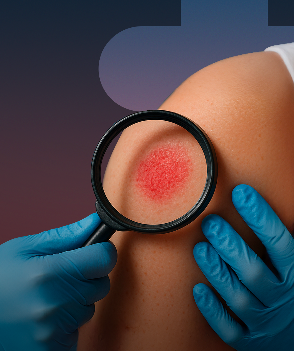 Les manifestations dermatologiques