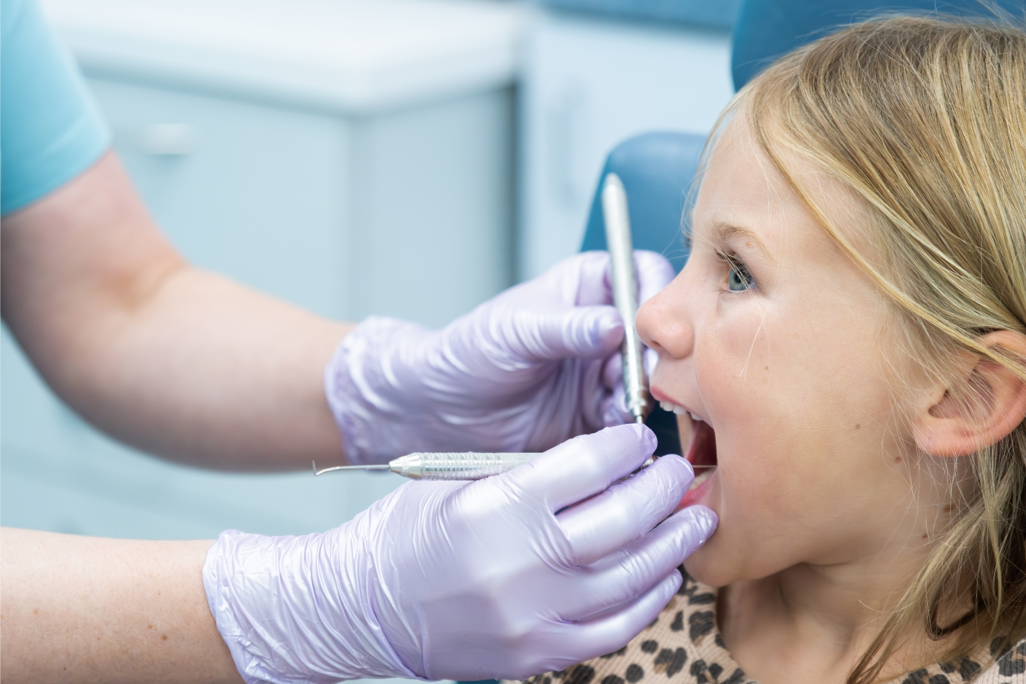 Pediatric Dental Crowns in San Juan Capistrano