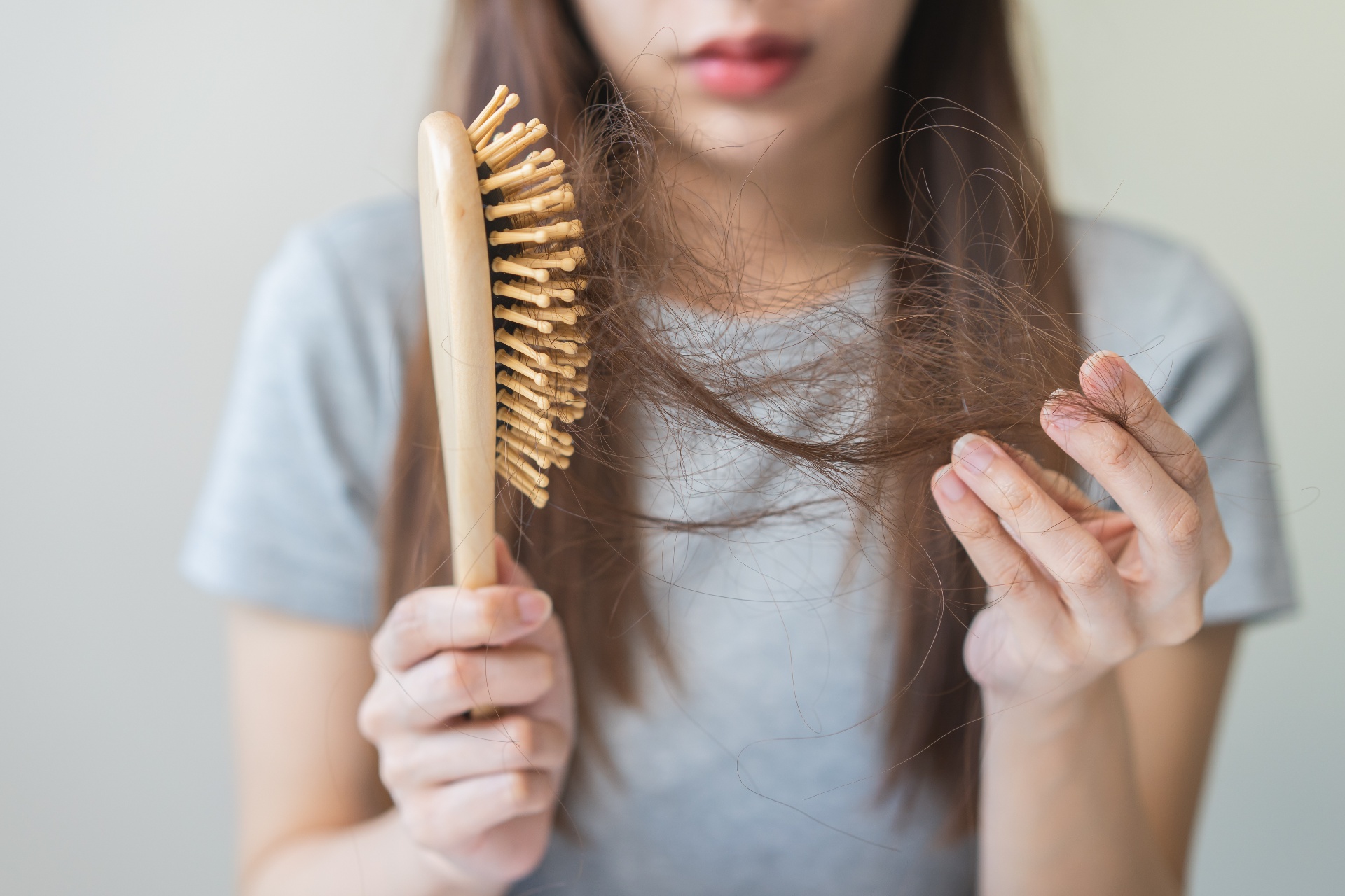 If Hair Loss Is So Common, Why Aren’t There Better Answers?