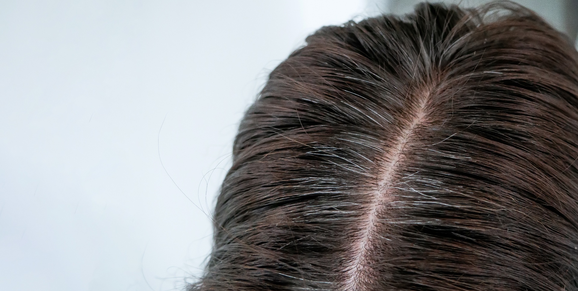 So Even Women With Thick Hair Can Experience Thinning During Perimenopause and Menopause?