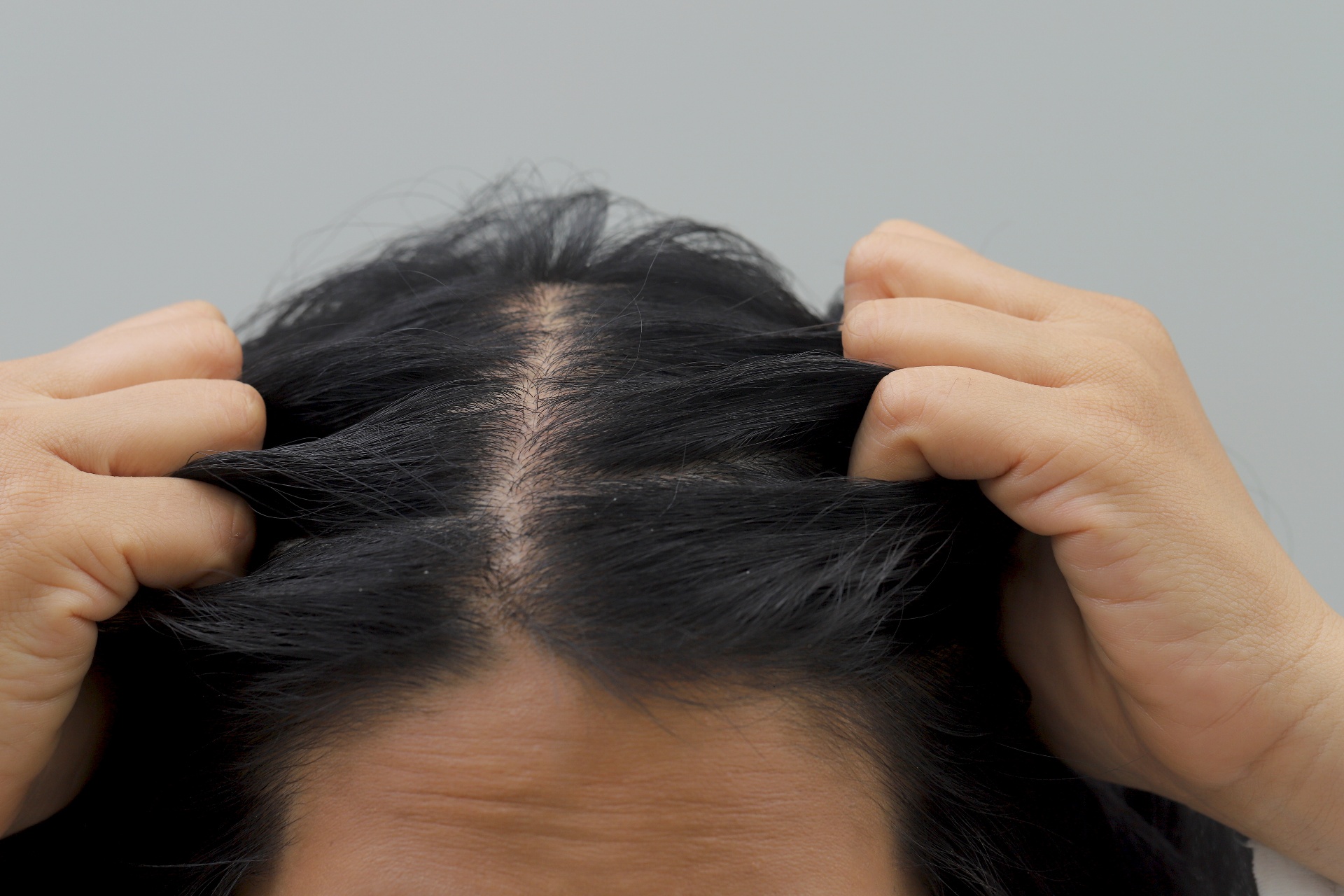 If There’s No “Magic Cure” For Women’s Hair Loss, What Can You Do?