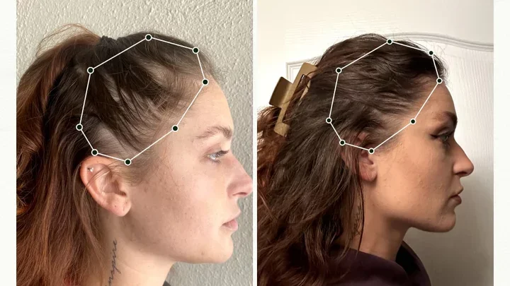 How Bio-Pilixin® Helps Support Fuller-Looking Hair Over Time