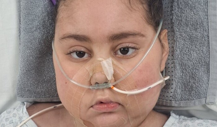 "Campanha busca apoio para cadeira de rodas adaptada e conforto de menina com tumor cerebral"