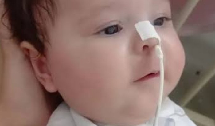 Pai busca apoio para tratamento urgente do filho com distrofia muscular espinhal e qualidade de vida
