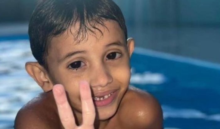 Dudu precisa de ajuda urgente para cirurgia que pode preservar sua visão após cinco procedimentos anteriores