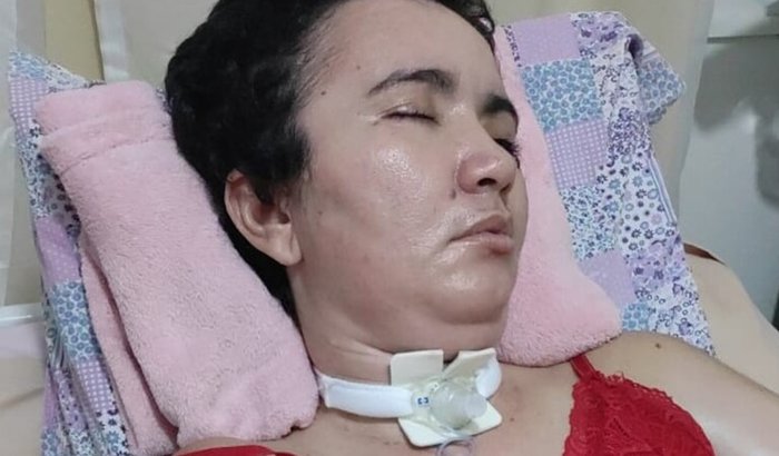 "Família luta por apoio financeiro após AVC hemorrágico de Elizandra e enfrenta desafios diários"