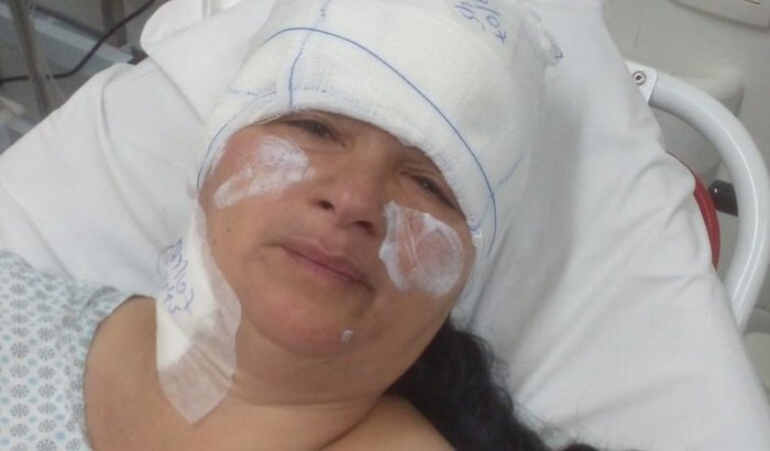 Solidariedade em ação: ajude a reconstruir o lar de Dona Sanzita após incêndio devastador