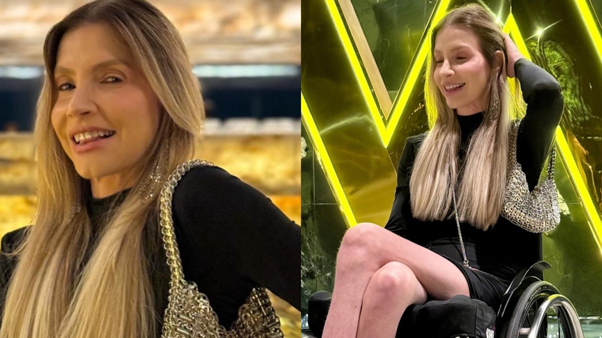"Andrea Schwarz denuncia discriminação em restaurante de luxo e clama por empatia e acessibilidade"