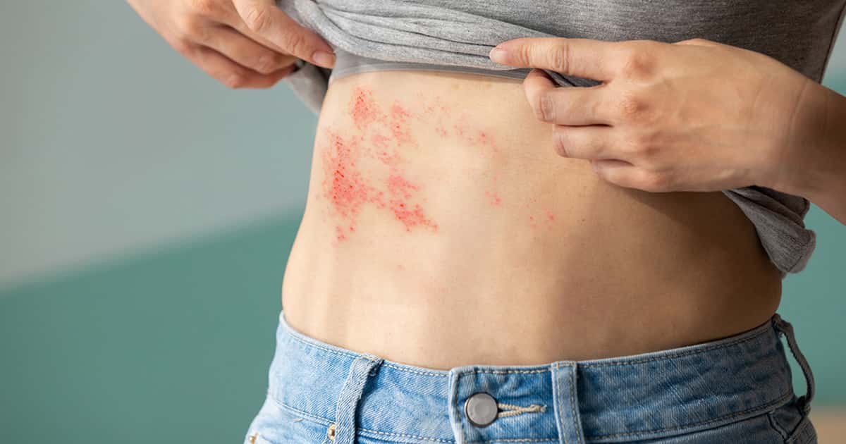 Mudanças climáticas ampliam risco da Doença de Chagas em regiões antes seguras do Brasil