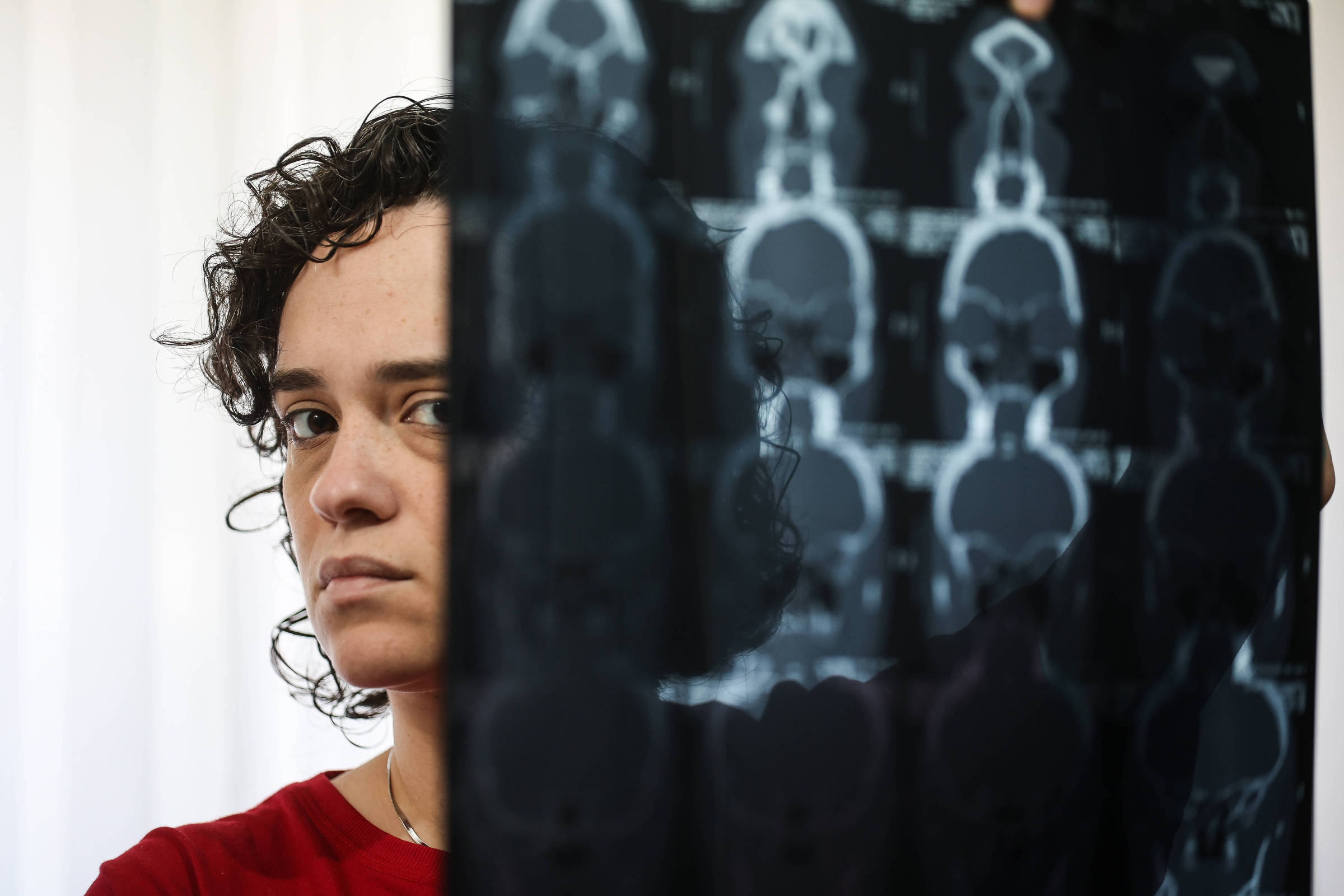 Síndrome da fadiga crônica: desafios no diagnóstico e a luta por reconhecimento no Brasil