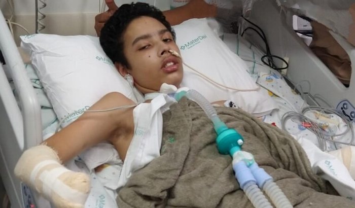"Adolescente supera desafios após complicações graves de saúde e precisa de apoio para tratamento e próteses"