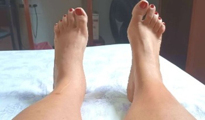 "Mulher aguarda há quatro anos por cirurgia no pé e busca apoio para tratamento particular"