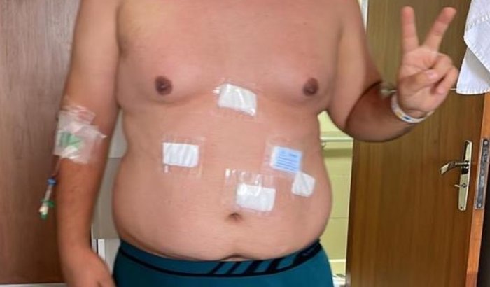 Igor busca apoio financeiro para cirurgia de correção após cirurgia bariátrica e perda de peso significativa