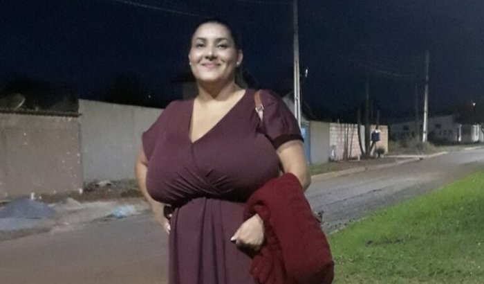Vaquinha busca apoio para cirurgia de redução de mama e alívio de dores crônicas