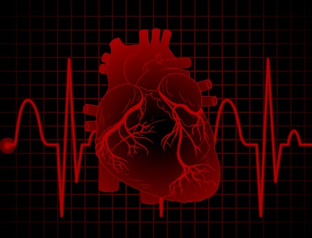 Níveis elevados de glicose revelam risco maior de danos cardíacos em pacientes com infarto agudo do miocárdio