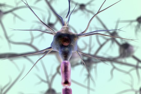 Cientistas brasileiros desenvolvem ferramenta para prever eficácia do natalizumabe em pacientes com esclerose múltipla