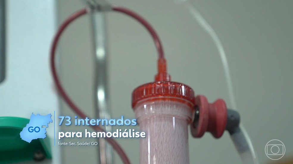 Falta de vagas em clínicas de hemodiálise leva pacientes a ocuparem leitos em hospitais públicos de Goiás
