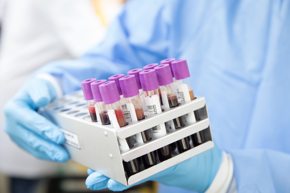 Hepatites virais causam mais de 1,3 milhão de mortes anuais e OMS pede ações urgentes para combatê-las
