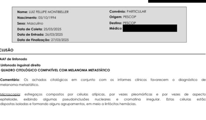 "Luiz Fellipe Montibeller busca apoio para tratamento de melanoma em estágio avançado"
